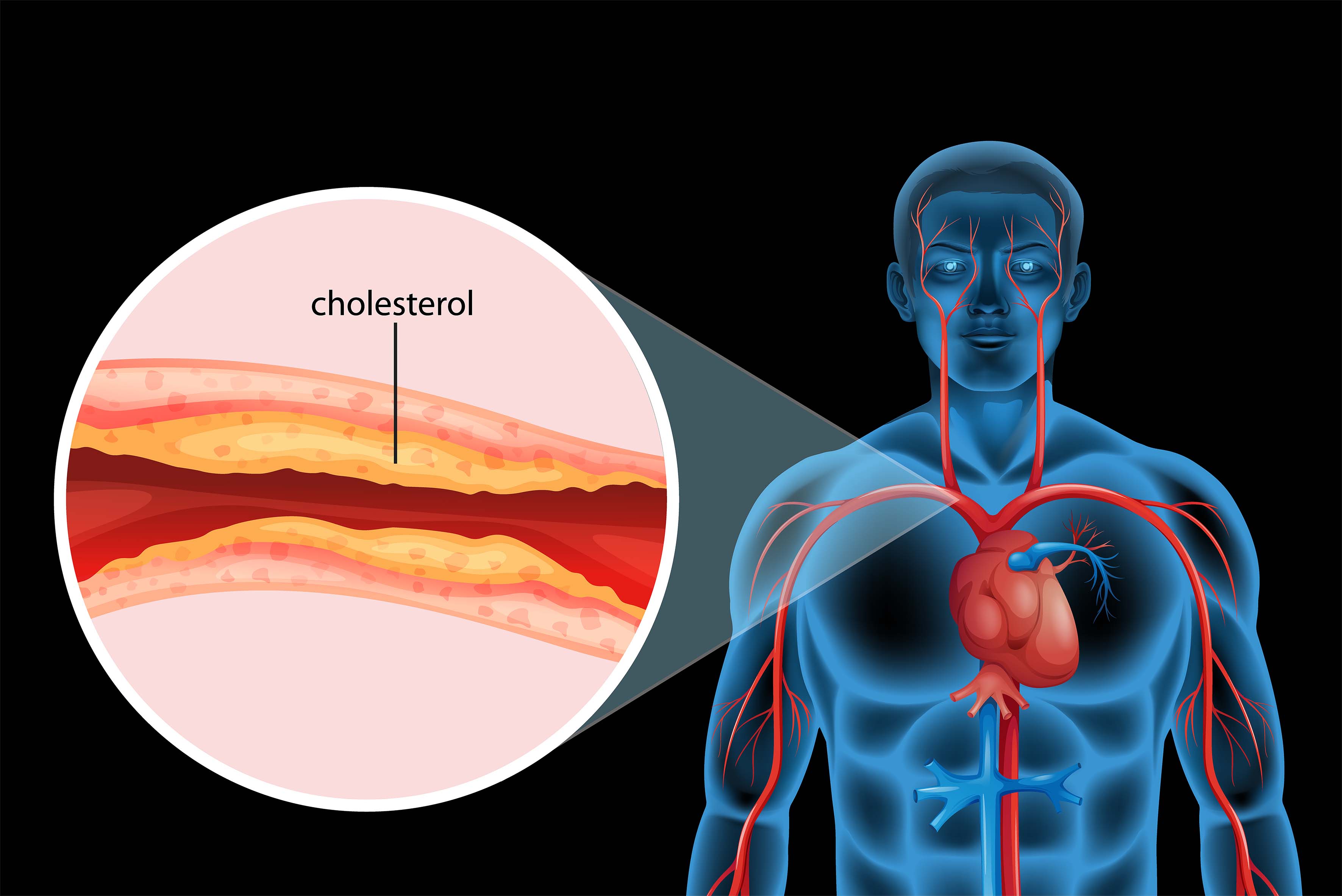 LDL ve HDL Kolesterol
