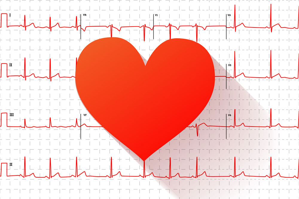 EKG (Kalp Şeridi)
