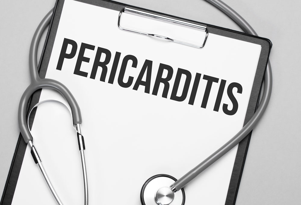 Perikardit (Kalp Zarı Hastalığı)